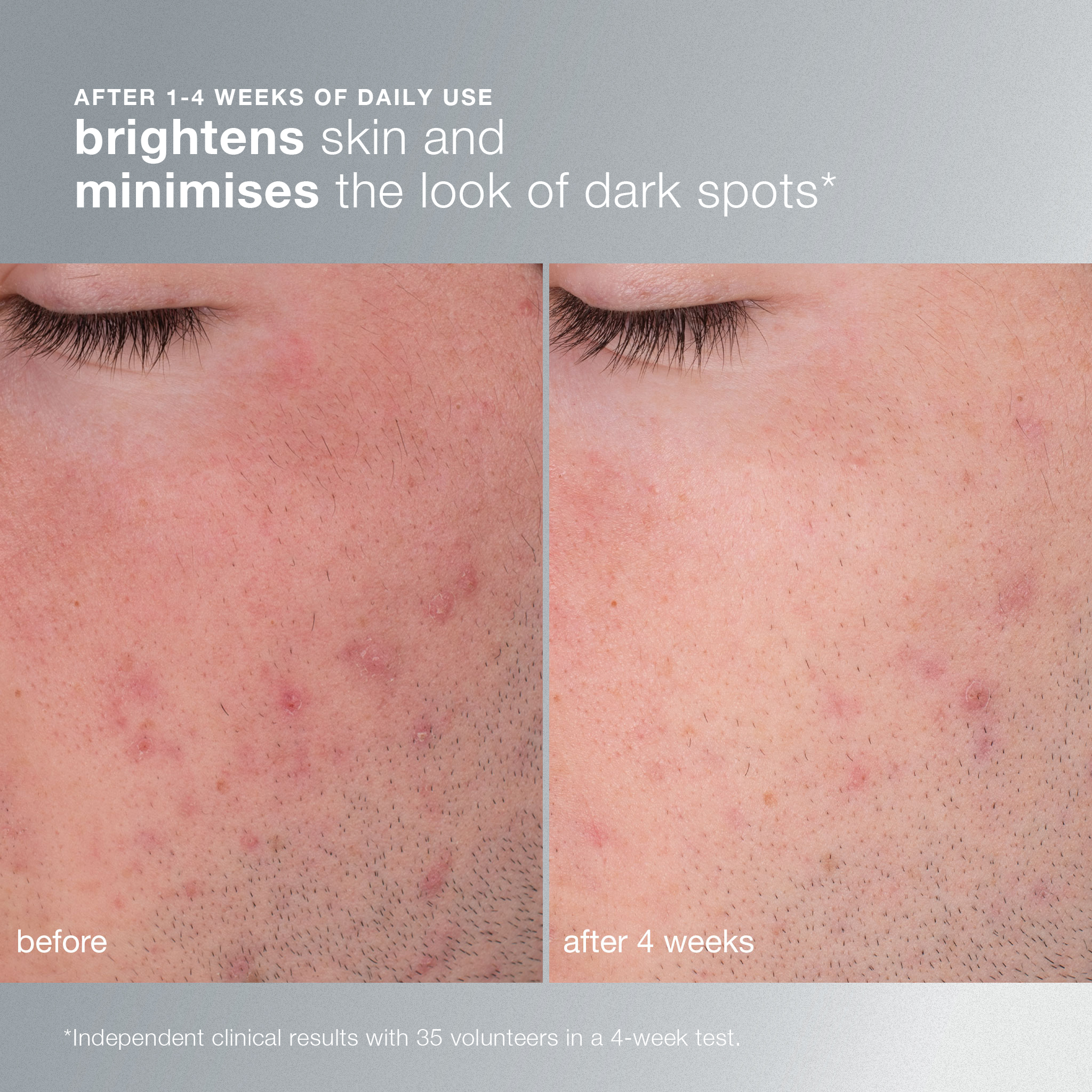 daily microfoliant ® - Image 4