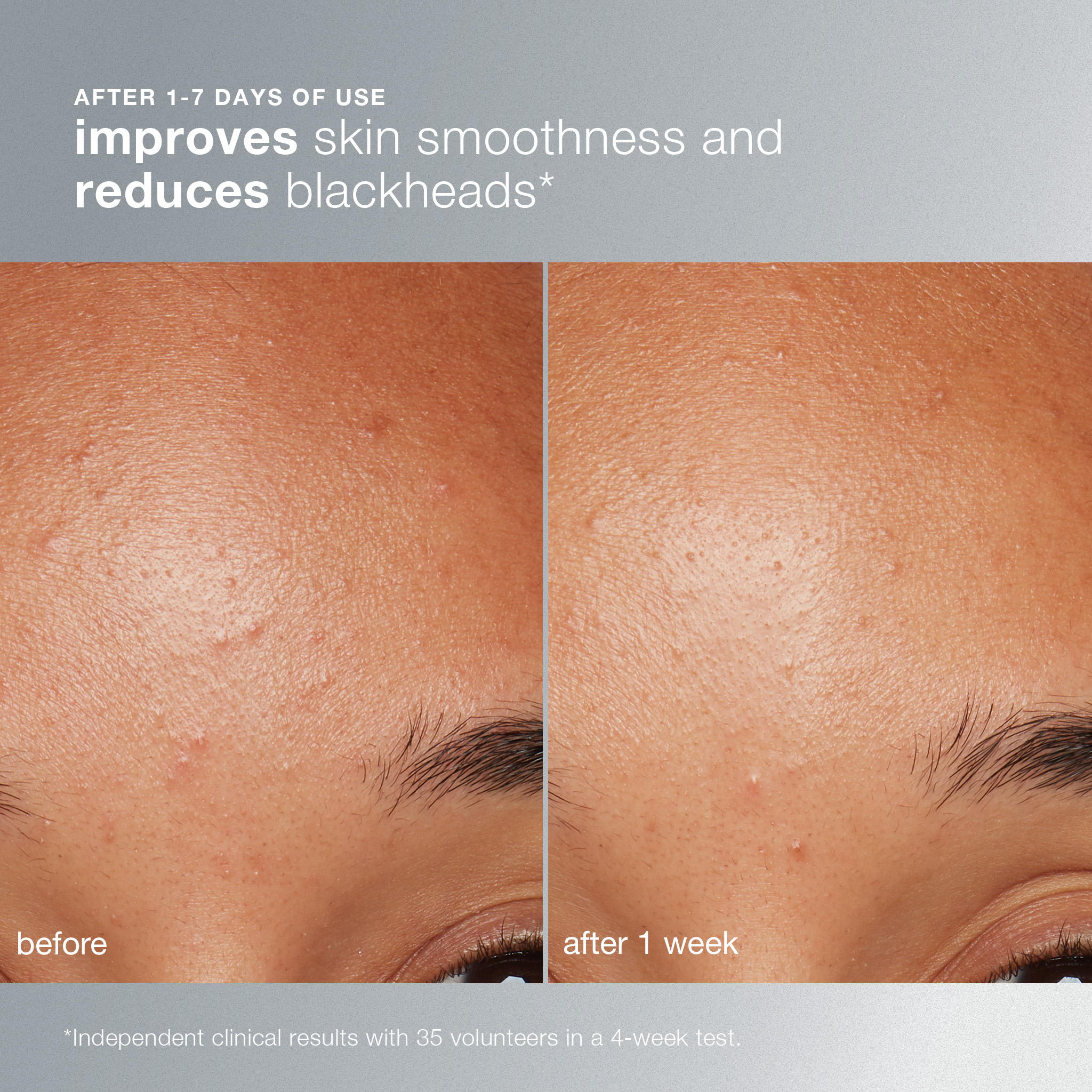 daily microfoliant ® - Image 5