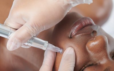 Pro NanoInfusion