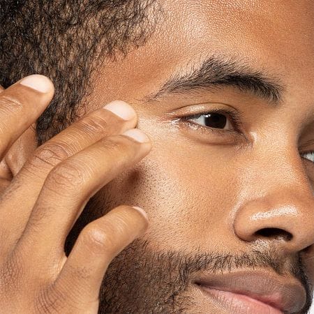 man with puffy eyes