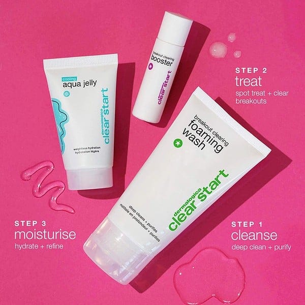 Clear Start Breakout Clearing kit - Image 3