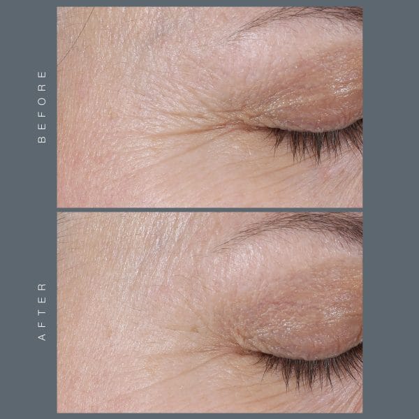 Phyto-Nature Firming Serum - Image 6