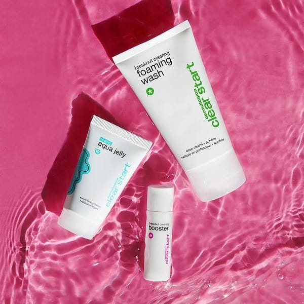Clear Start Breakout Clearing kit - Image 6