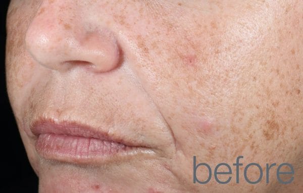Retinol Clearing oil - Image 5