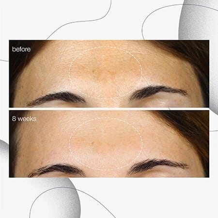 Powerbright Dark Spot Serum - Image 5