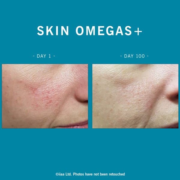Skin Omegas+ - Image 7