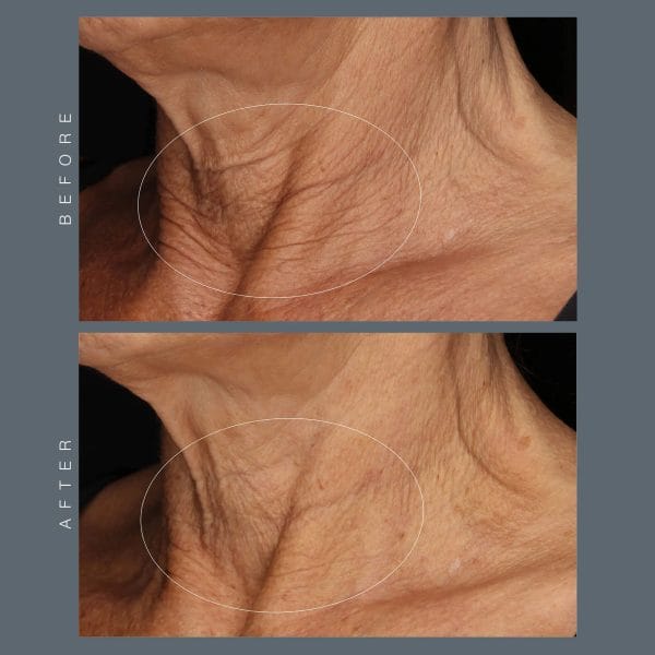 Neck Fit Contour Serum - Image 6