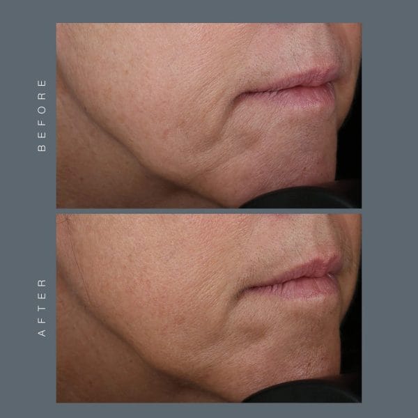 Phyto-Nature Firming Serum - Image 7