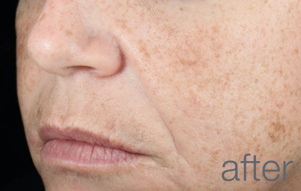 Retinol Clearing oil - Image 6