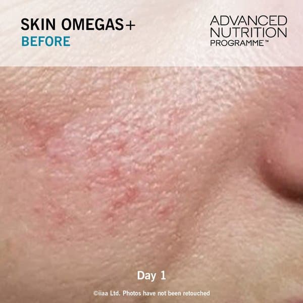Skin Omegas+ - Image 8