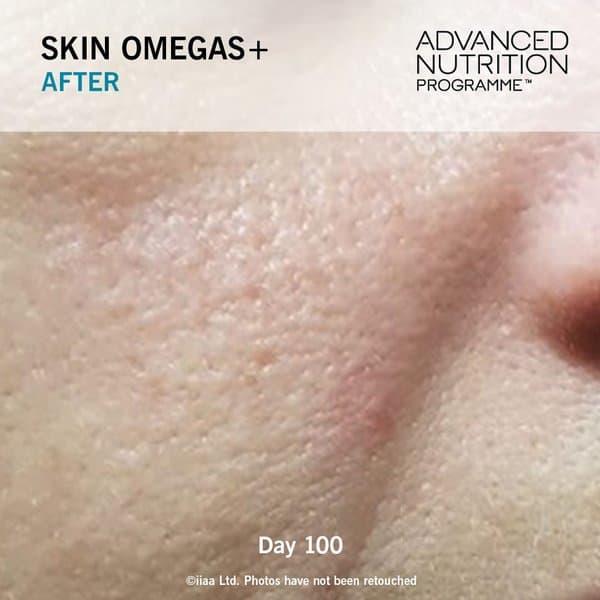 Skin Omegas+ - Image 9