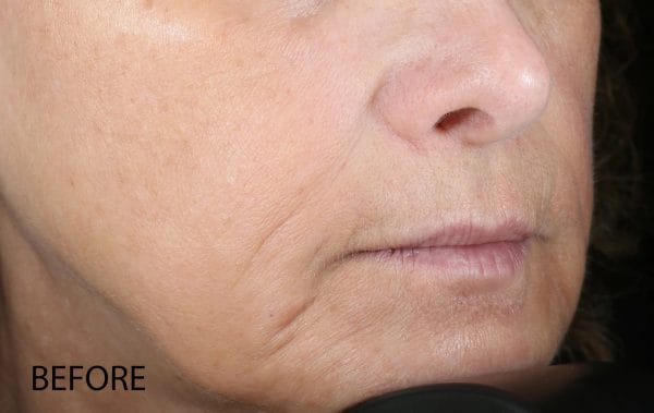 Biolumin-C Serum - Image 6
