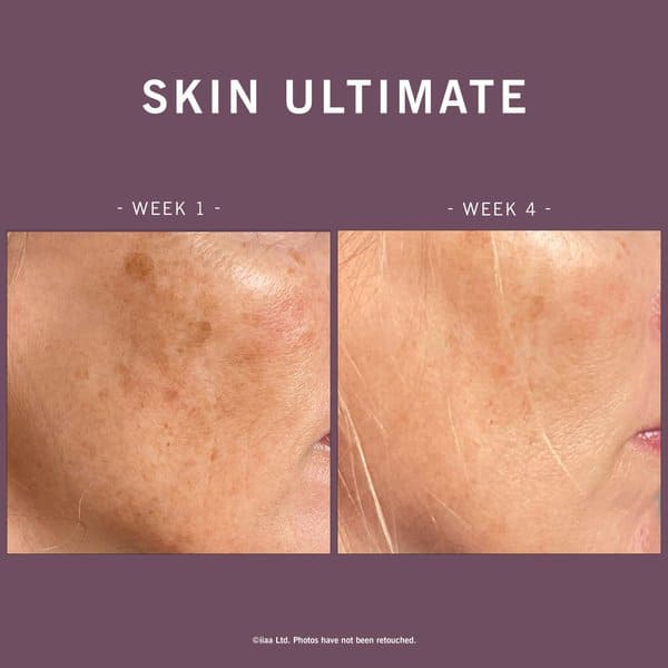 Skin Ultimate - Image 3