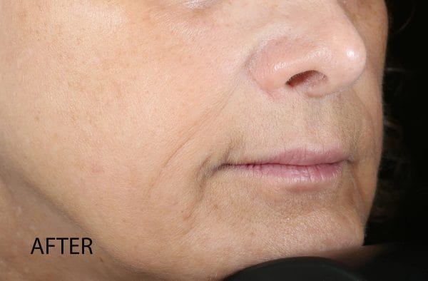 Biolumin-C Serum - Image 7